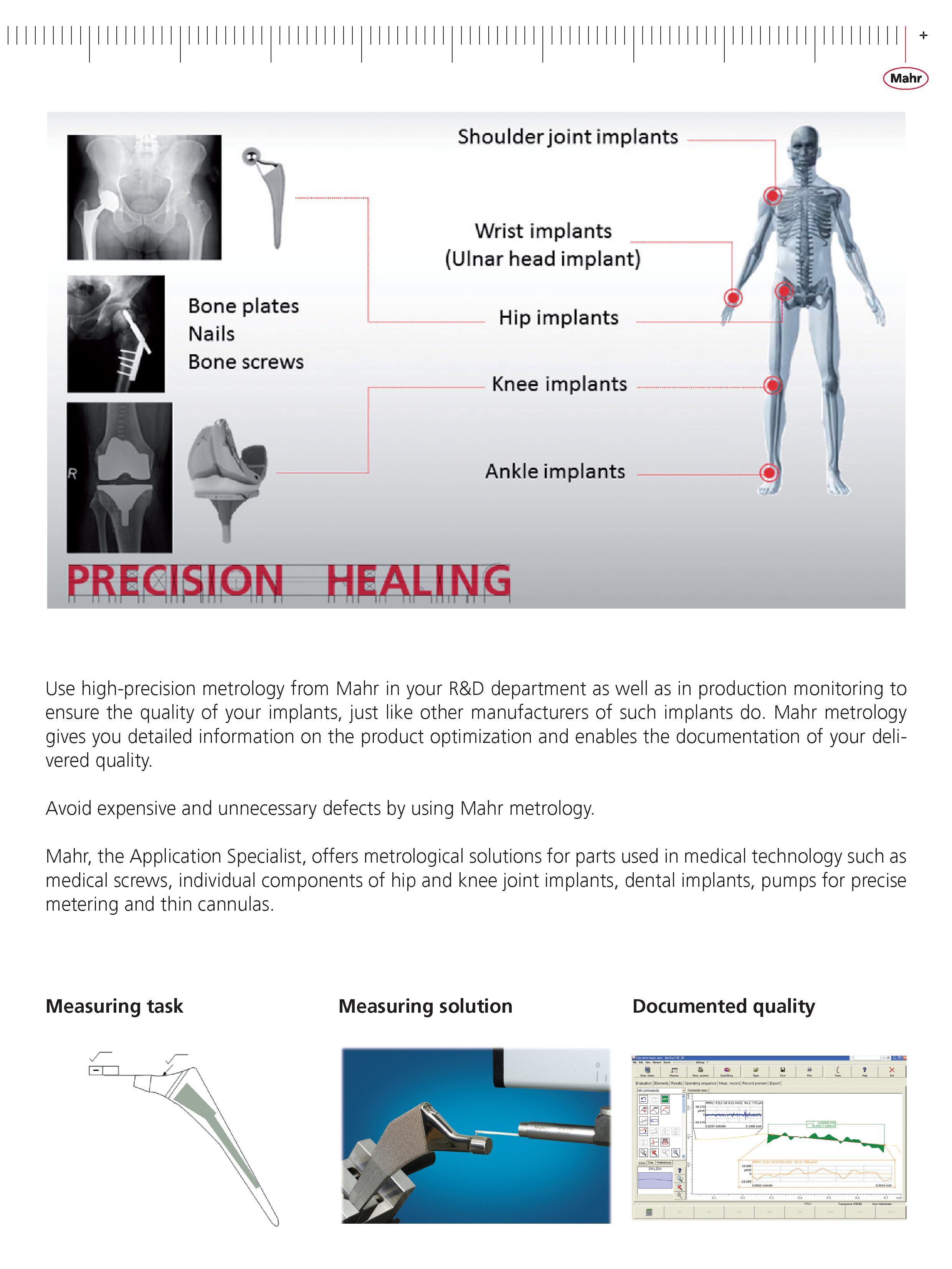 15 Mahr Use high-precision metrology from Mahr in your R&D department as well as in production monitoring to ensure the quality of your implants j Каталог MAHR 2014 Измерительные инструменты приборы и оборудование для линейно-угловых измерений в машиностроении Стр.  ENG